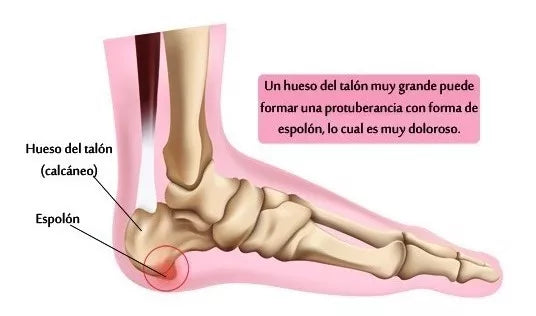 Plantillas Ortopédicas Ajustables (1 par)
